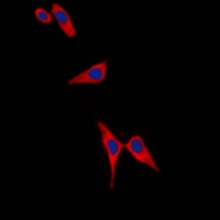 Tyrosine Hydroxylase (Phospho-S19) Rabbit Polyclonal Antibody