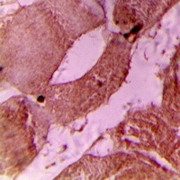 cTnI (Phospho-S22/S23) Rabbit Polyclonal Antibody
