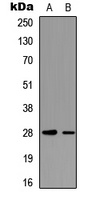 cTnI (Phospho-T142) Rabbit Polyclonal Antibody