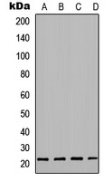 sTnT Rabbit Polyclonal Antibody