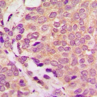 ULK3 Rabbit Polyclonal Antibody