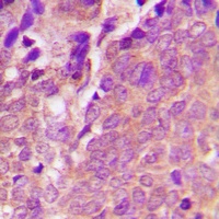 VASP (Phospho-S238) Rabbit Polyclonal Antibody