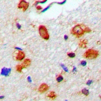 WASP (Phospho-Y290) Rabbit Polyclonal Antibody