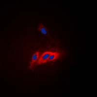 WASP (Phospho-Y290) Rabbit Polyclonal Antibody
