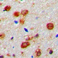WWOX Rabbit Polyclonal Antibody