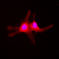 SGK1 (Phospho-S422) Rabbit Polyclonal Antibody