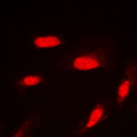 AKT (Phospho-S246) Rabbit Polyclonal Antibody