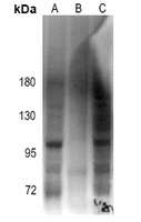 Androgen Receptor (Phospho-S213) Rabbit Polyclonal Antibody