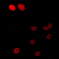 Androgen Receptor (Phospho-S213) Rabbit Polyclonal Antibody