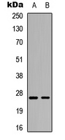 RhoGDI alpha (Phospho-S174) Rabbit Polyclonal Antibody