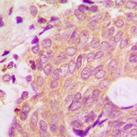 Beta-arrestin-1 Rabbit Polyclonal Antibody