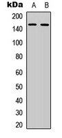 ATP7B Rabbit Polyclonal Antibody