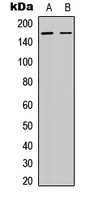 BCR (Phospho-Y360) Rabbit Polyclonal Antibody