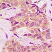 BCR (Phospho-Y360) Rabbit Polyclonal Antibody