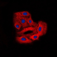 BCR (Phospho-Y360) Rabbit Polyclonal Antibody