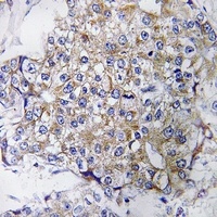Complement C1QB Rabbit Polyclonal Antibody