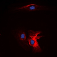 Complement C1QB Rabbit Polyclonal Antibody