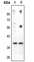 CD88 Rabbit Polyclonal Antibody