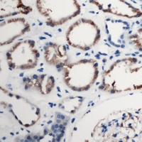 CD88 Rabbit Polyclonal Antibody