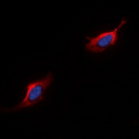 CD88 Rabbit Polyclonal Antibody