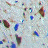 CaMK4 (Phospho-T200) Rabbit Polyclonal Antibody