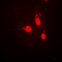 CaMK4 (Phospho-T200) Rabbit Polyclonal Antibody