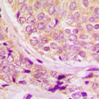 Cyclin B1 (Phospho-S147) Rabbit Polyclonal Antibody
