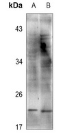 Cofilin Rabbit Polyclonal Antibody