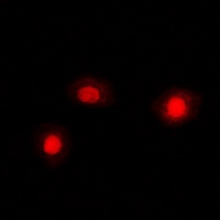 Cofilin Rabbit Polyclonal Antibody