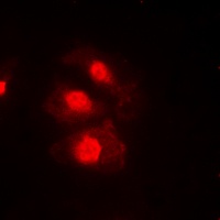 CHK1 (Phospho-S345) Rabbit Polyclonal Antibody