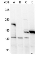Collagen 18 alpha 1 Rabbit Polyclonal Antibody