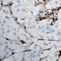 Collagen 18 alpha 1 Rabbit Polyclonal Antibody