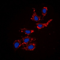 Collagen 18 alpha 1 Rabbit Polyclonal Antibody