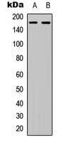 Collagen 4 alpha 6 Rabbit Polyclonal Antibody