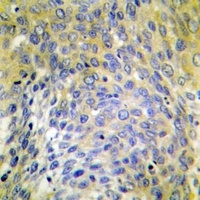 Collagen 4 alpha 6 Rabbit Polyclonal Antibody