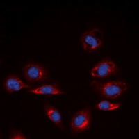 Collagen 4 alpha 6 Rabbit Polyclonal Antibody