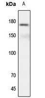 CD115 Rabbit Polyclonal Antibody