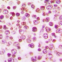 CD115 Rabbit Polyclonal Antibody