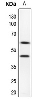 CD116 Rabbit Polyclonal Antibody