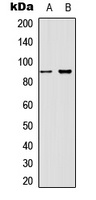 Beta-catenin (Phospho-T41/S45) Rabbit Polyclonal Antibody