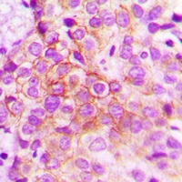 Catenin delta 1 (Phospho-Y228) Rabbit Polyclonal Antibody