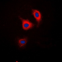 Catenin delta 1 (Phospho-Y228) Rabbit Polyclonal Antibody