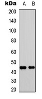 CD182 (Phospho-S347) Rabbit Polyclonal Antibody