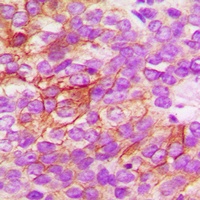 CD182 (Phospho-S347) Rabbit Polyclonal Antibody