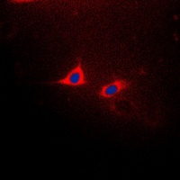 CD182 (Phospho-S347) Rabbit Polyclonal Antibody