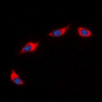 CD182 Rabbit Polyclonal Antibody