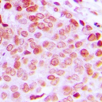 DDX5 (Phospho-Y593) Rabbit Polyclonal Antibody