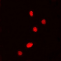 DDX5 (Phospho-Y593) Rabbit Polyclonal Antibody