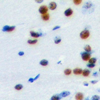 ELK1 Rabbit Polyclonal Antibody