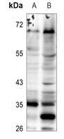 ELOVL5 Rabbit Polyclonal Antibody